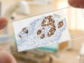Prestige Biopharma IDC Publishes IHC-Based PAUF Diagnostic Platform Study in International Journal