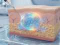 Prestige Biopharma IDC Files Patent for Next-Generation Antibody Delivery Platform ‘IDC224’